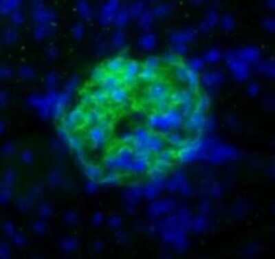 Immunohistochemistry: Podoplanin Antibody (8.1.1) - BSA Free [NB600-1015]