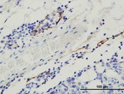 Immunohistochemistry-Paraffin: Podoplanin Antibody (8.1.1) - BSA Free [NB600-1015]