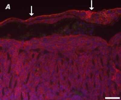 Immunohistochemistry-Paraffin: Podoplanin Antibody (8.1.1) - BSA Free [NB600-1015]
