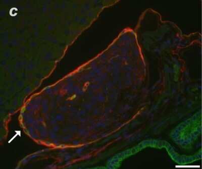 Immunohistochemistry-Paraffin: Podoplanin Antibody (8.1.1) - BSA Free [NB600-1015]