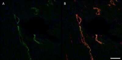 Immunohistochemistry: Podoplanin Antibody (LF3/B7/D5B27) - Azide and BSA Free [NBP2-80915]