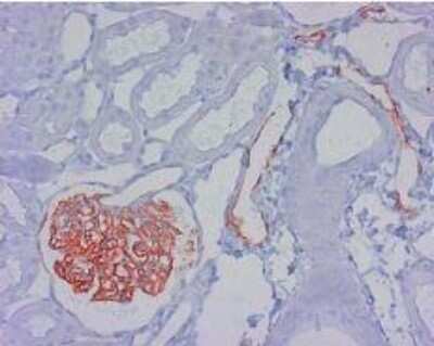 Immunohistochemistry: Podoplanin Antibody (LF3/B7/D5B27) - Azide and BSA Free [NBP2-80915]