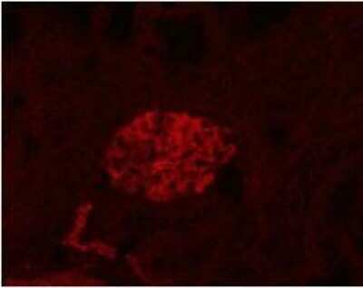 Immunohistochemistry: Podoplanin Antibody (LF3/B7/D5B27) - Azide and BSA Free [NB110-96423]
