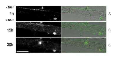 Live Imaging Microscopy: pSIVA Apoptosis Detection Kit [NBP2-29382]