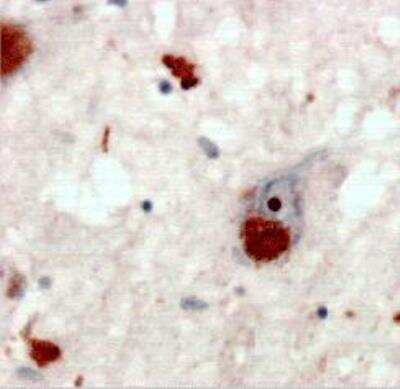 Immunohistochemistry-Paraffin: Poly-Ubiquitin Antibody (HWA4C4) - K63 Linkage [NBP2-36523]