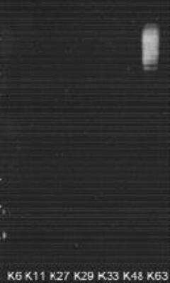 Western Blot: Poly-Ubiquitin Antibody (HWA4C4)K63 Linkage [NBP2-36523]