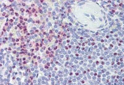 Immunohistochemistry-Paraffin: Polycystin-1/PKD1 Antibody [NBP1-52552]