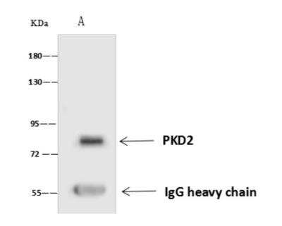 Immunoprecipitation: Polycystin 2 Antibody [NBP3-06363]
