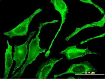 Immunocytochemistry/ Immunofluorescence: Polypeptide GalNac Transferase 1/GALNT1 Antibody (3C10) [H00002589-M10]