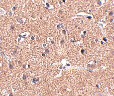 Immunohistochemistry-Paraffin: Polypeptide GalNac Transferase 10/GALNT10 Antibody - BSA Free [NBP1-77059]
