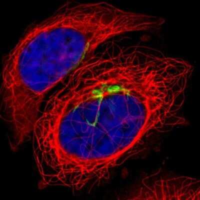 Immunocytochemistry/ Immunofluorescence: Polypeptide GalNac Transferase 3/GALNT3 Antibody [NBP1-81849]