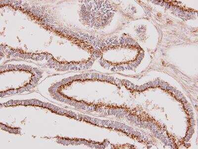 Immunohistochemistry-Paraffin: Polypeptide GalNac Transferase 7/GALNT7 Antibody [NBP1-32491]