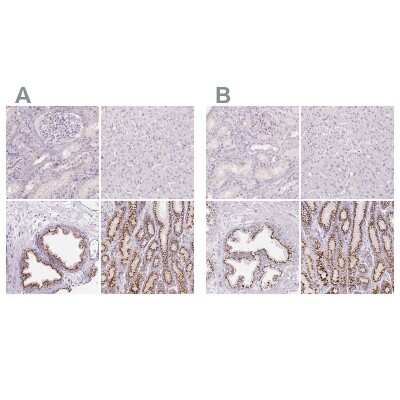 Immunohistochemistry-Paraffin: Polypeptide GalNac Transferase 7/GALNT7 Antibody [NBP2-39021]