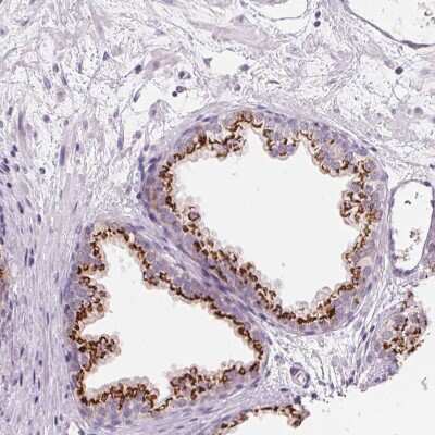 Immunohistochemistry-Paraffin: Polypeptide GalNac Transferase 7/GALNT7 Antibody [NBP2-39021]