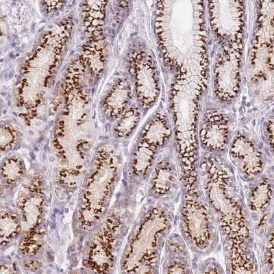 Immunohistochemistry-Paraffin: Polypeptide GalNac Transferase 7/GALNT7 Antibody [NBP2-39021]