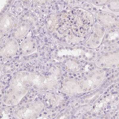 Immunohistochemistry-Paraffin: Polypeptide GalNac Transferase 7/GALNT7 Antibody [NBP2-39054]