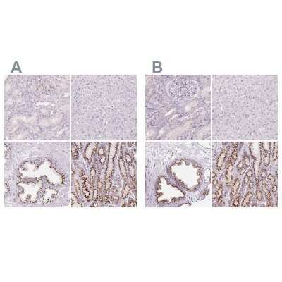 Immunohistochemistry-Paraffin: Polypeptide GalNac Transferase 7/GALNT7 Antibody [NBP2-39054]