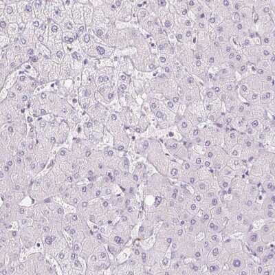 Immunohistochemistry-Paraffin: Polypeptide GalNac Transferase 7/GALNT7 Antibody [NBP2-39054]