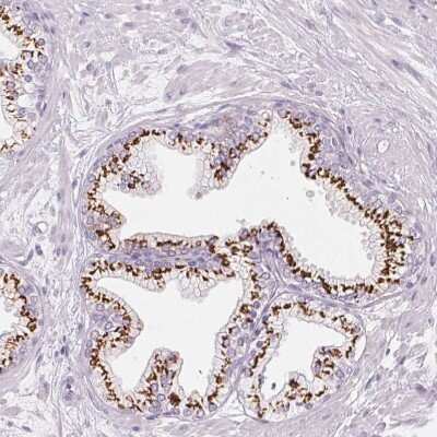 Immunohistochemistry-Paraffin: Polypeptide GalNac Transferase 7/GALNT7 Antibody [NBP2-39054]