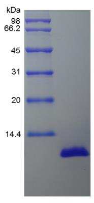 SDS-PAGE: Recombinant Porcine CXCL8/IL-8 Protein [NBP2-35234]
