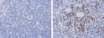 Immunohistochemistry-Paraffin: Porcine Circovirus 2 Capsid Antibody (GT863) [NBP3-13603]