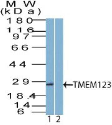 Western Blot: Porimin Antibody [NBP2-27172]