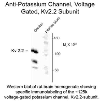 Western Blot: Potassium Channel Kv2.2 Antibody [NB300-261]
