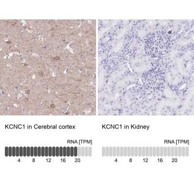 Immunohistochemistry-Paraffin: Potassium Channel Kv3.1 Antibody [NBP2-30395]
