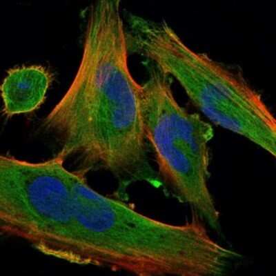 Immunocytochemistry/ Immunofluorescence: Pref-1/DLK1/FA1 Antibody (3A10) - BSA Free [NBP2-37548]