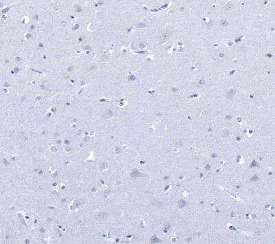 Immunohistochemistry-Paraffin: Pref-1/DLK1/FA1 Antibody [NBP2-32358]