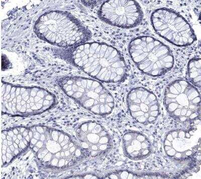 Immunohistochemistry-Paraffin: Pref-1/DLK1/FA1 Antibody [NBP2-32358]