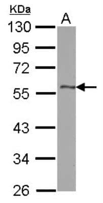 Western Blot: Pref-1/DLK1/FA1 Antibody [NBP2-16177]