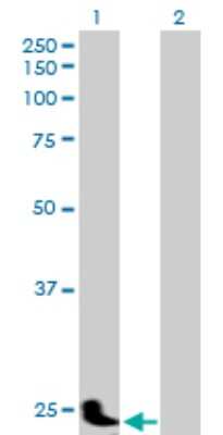 Western Blot: Pregnancy specific beta 1 glycoprotein 11 Antibody [H00005680-B01P]