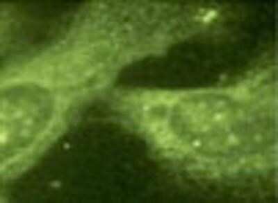 Immunocytochemistry/ Immunofluorescence: Presenilin-1 Antibody (APS 11) [NB300-749]