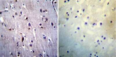 Immunohistochemistry-Paraffin: Presenilin-1 Antibody (APS 11) [NB300-749]