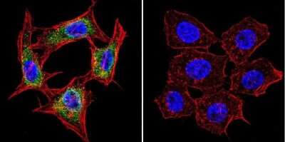 Immunocytochemistry/ Immunofluorescence: Presenilin-1 Antibody (APS 18) [NB100-74510]