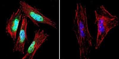 Immunocytochemistry/ Immunofluorescence: Presenilin-1 Antibody (APS 18) [NB100-74510]