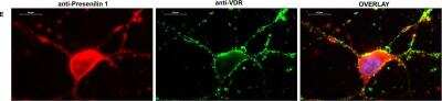 Immunocytochemistry/ Immunofluorescence: Presenilin-1 Antibody - BSA Free [NBP1-76792]