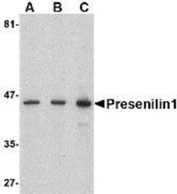 Western Blot: Presenilin-1 AntibodyBSA Free [NBP1-76792]
