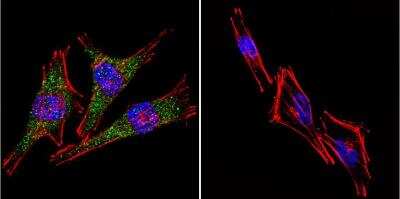 Immunocytochemistry/ Immunofluorescence: Presenilin-2 Antibody (APS 21) [NB100-74512]