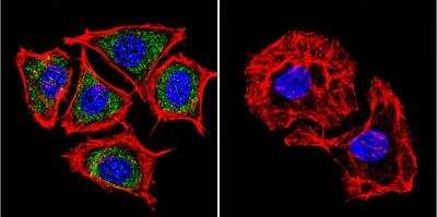 Immunocytochemistry/ Immunofluorescence: Presenilin-2 Antibody (APS 21) [NB100-74512]