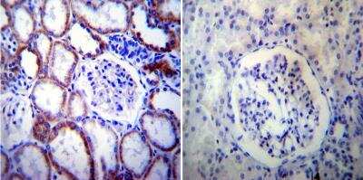 Immunohistochemistry-Paraffin: Presenilin-2 Antibody (APS 21) [NB100-74512]