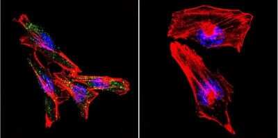 Immunocytochemistry/ Immunofluorescence: Presenilin-2 Antibody (APS 26) [NB100-74513]
