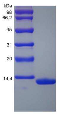 SDS-PAGE: Recombinant Rhesus Macaque Serum Amyloid A1 Protein [NBP2-35320]