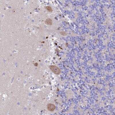 Immunohistochemistry-Paraffin: PrPC Antibody [NBP2-38508]