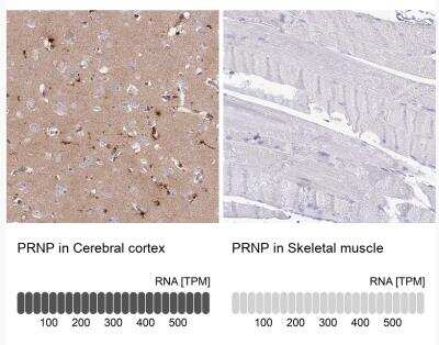 Immunohistochemistry-Paraffin: PrPC Antibody [NBP1-92285]
