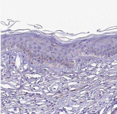 Immunohistochemistry-Paraffin: PrPC Antibody [NBP1-92285]