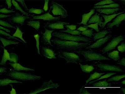Immunocytochemistry/ Immunofluorescence: ProSAPiP1 Antibody [H00009762-B01P]