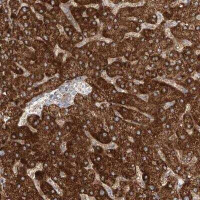 Immunohistochemistry: ProSAPiP1 Antibody [NBP1-90918]
