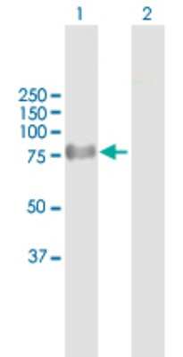 Western Blot: ProSAPiP1 Antibody [H00009762-B01P]